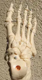 vascular disease laguna hills